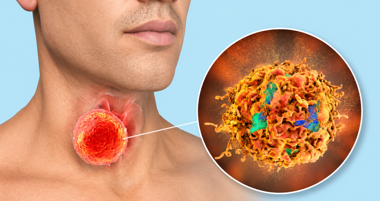 HPV ΚΑΙ ΩΡΛ