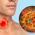 HPV ΚΑΙ ΩΡΛ
